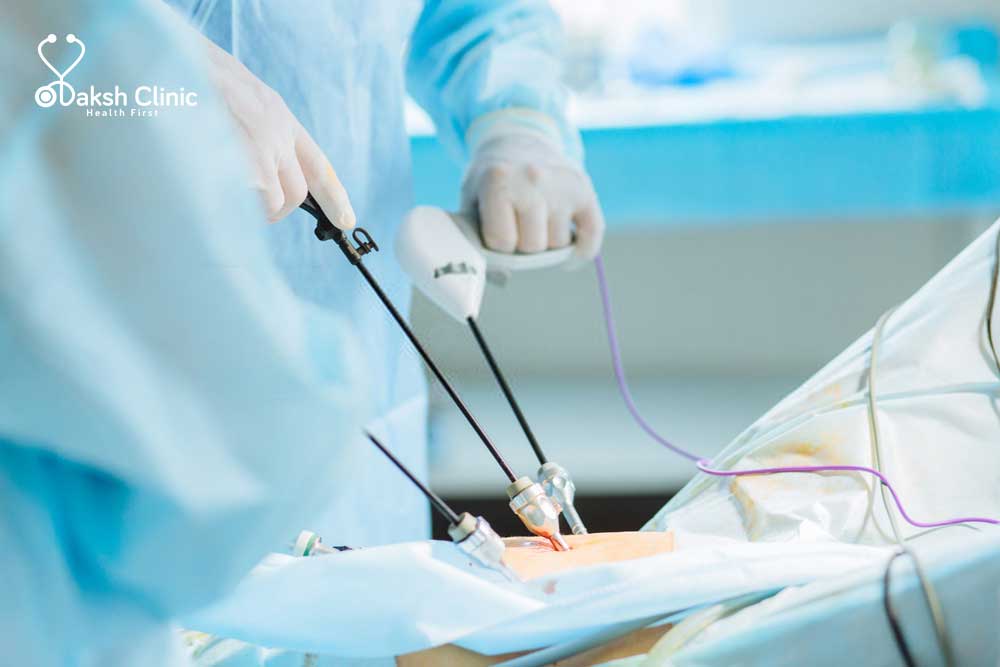 uterus removal surgery
